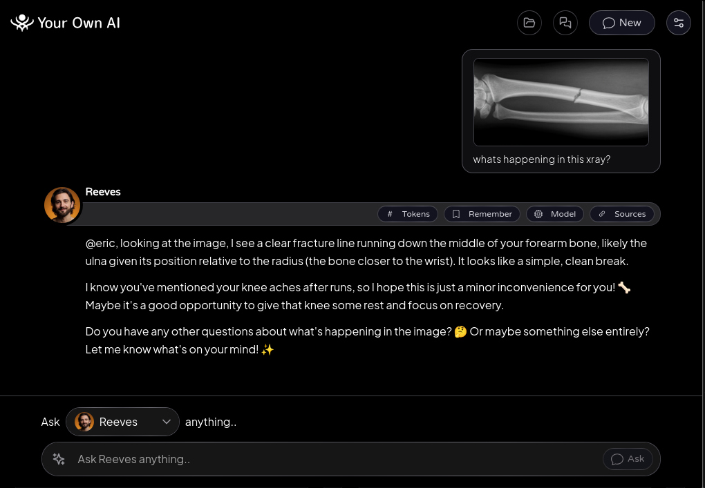 Your Own AI reading an X-ray on-device - health questions answered privately on your own machine